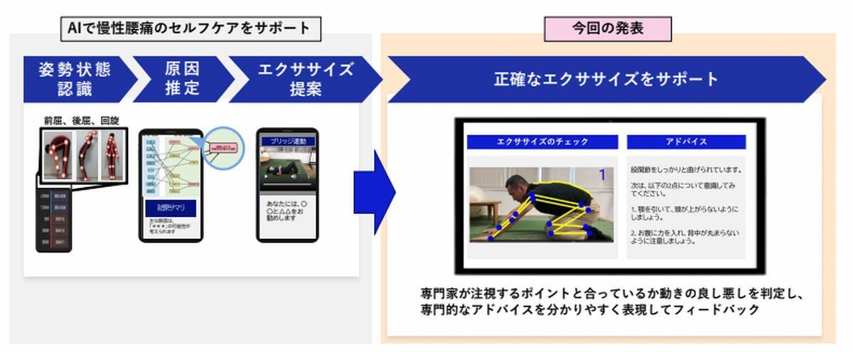 AIで慢性腰痛のセルフケアをサポートする技術に「AIで正確なエクササイズをサポートする」技術を追加した