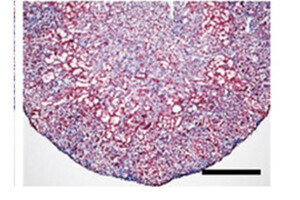 慢性腎臓病をiPS技術で治療 京大など、マウスで効果確認 数年以内に臨床試験目指す