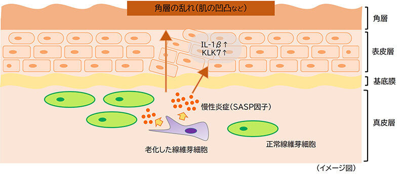 肌表面の凹凸：肌表面を構成する表皮の最外層である角層に乱れが生じることで肌に細かいくぼみが生じている状態