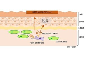 真皮の老化による慢性炎症が肌表面の凹凸形成に関与 - 第一三共ヘルスケアが解明
