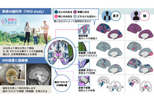 東北大、父母と子で脳の似る領域が子の性別で異なることを発見