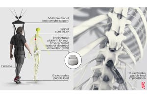 近未来テクノロジー見聞録 第261回 脊髄損傷で歩行が困難な人の歩行機能を改善させるニューロンを特定！