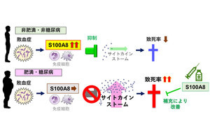 近未来テクノロジー見聞録 第262回 肥満症や糖尿病を持つ人は感染症が重症化しやすくなるメカニズムを解明