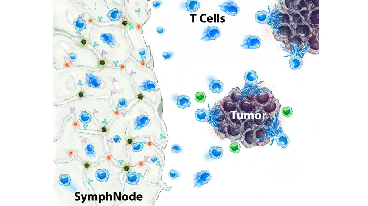 がんである固形腫瘍とがんを殺すSymphNodeのイメージ図