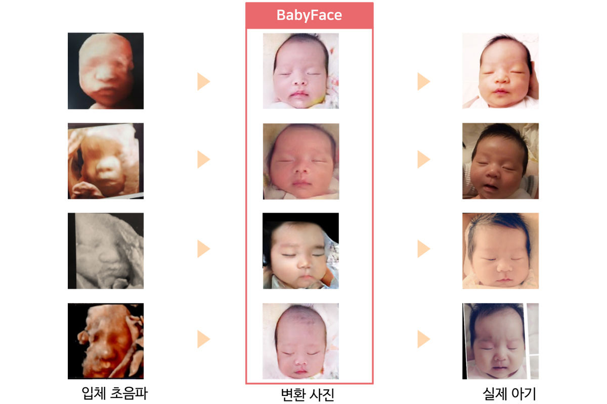 「BabyFace」より予測された胎児の顔画像と実際の赤ちゃんの写真