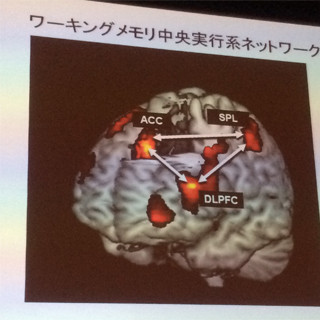 記憶の脳科学 第1回 低下したワーキングメモリ(脳のメモ帳)の機能は強化できるのか?