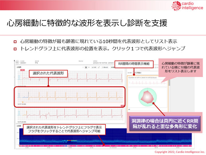 SmartRobin の画面サンプルと診断サポート機能