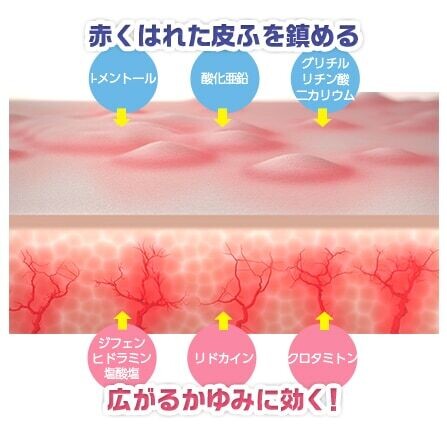 蕁麻疹イメージ