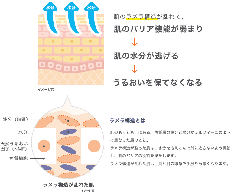ラメラ構造とは
