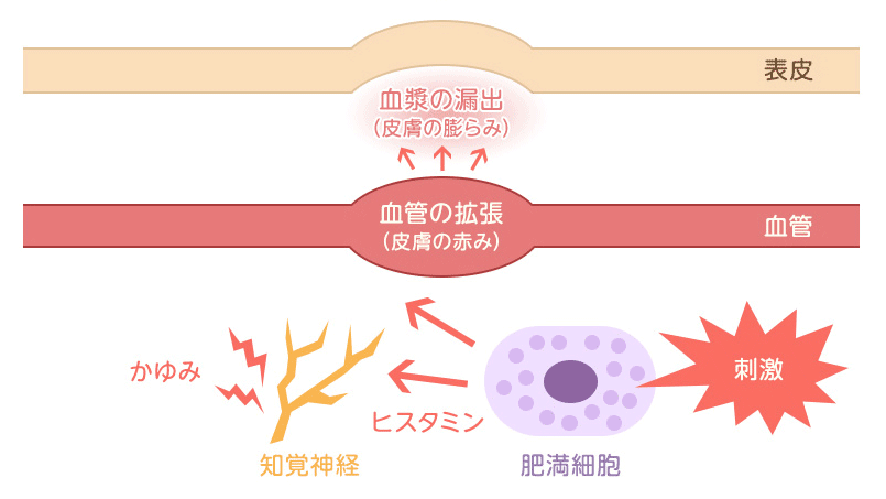 「マスト細胞（肥満細胞）」と「ヒスタミン」