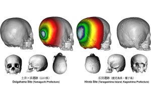 九大、未解明だった古代日本における意図的・人為的な頭蓋変形を確認